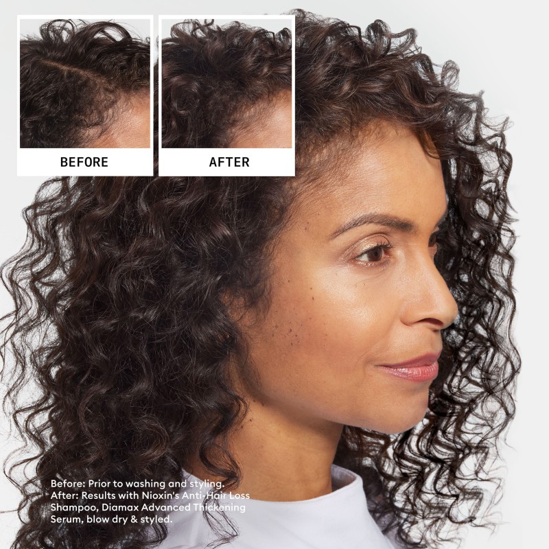 Nioxin Anti-Hairloss Shampoo 240 ml Nioxin Anti-Hairloss Shampoo 240 ml