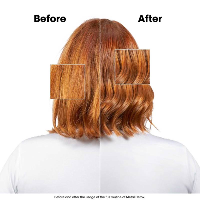 Metal DX Duo Gift Set 2025